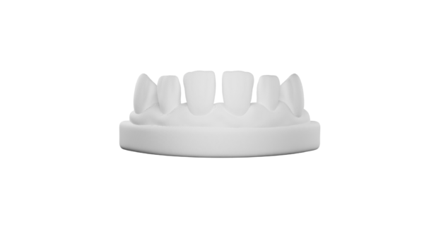 Diastema case